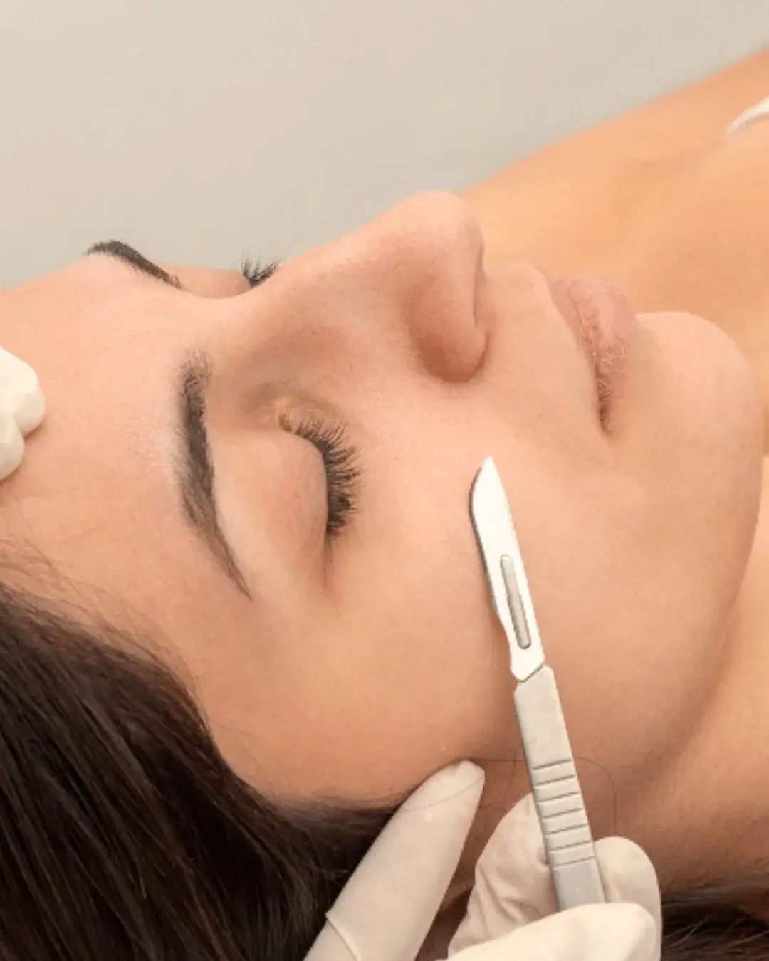 Dermaplane treatment