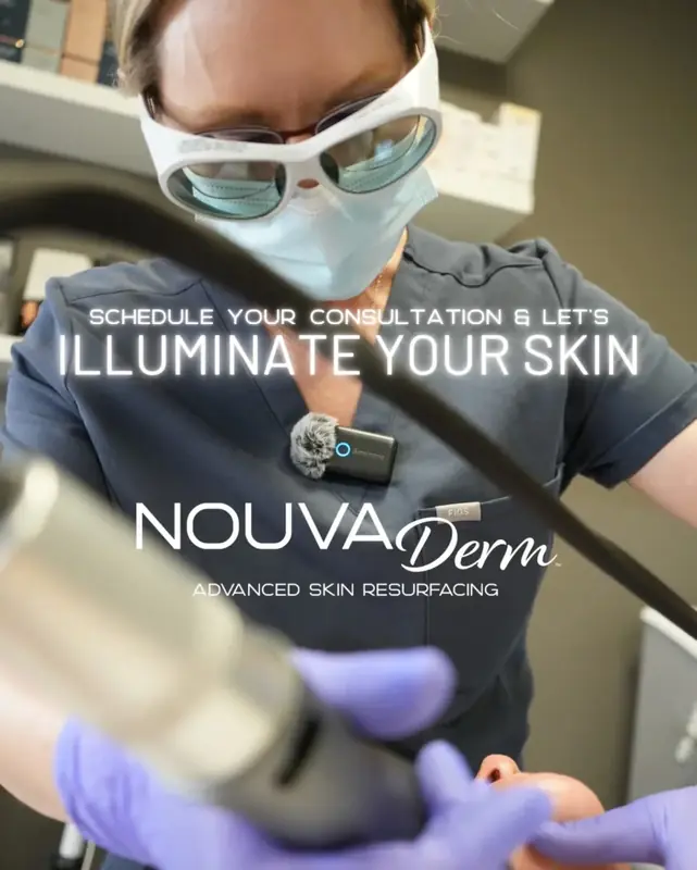 NOUVADERM skin resurfacing results