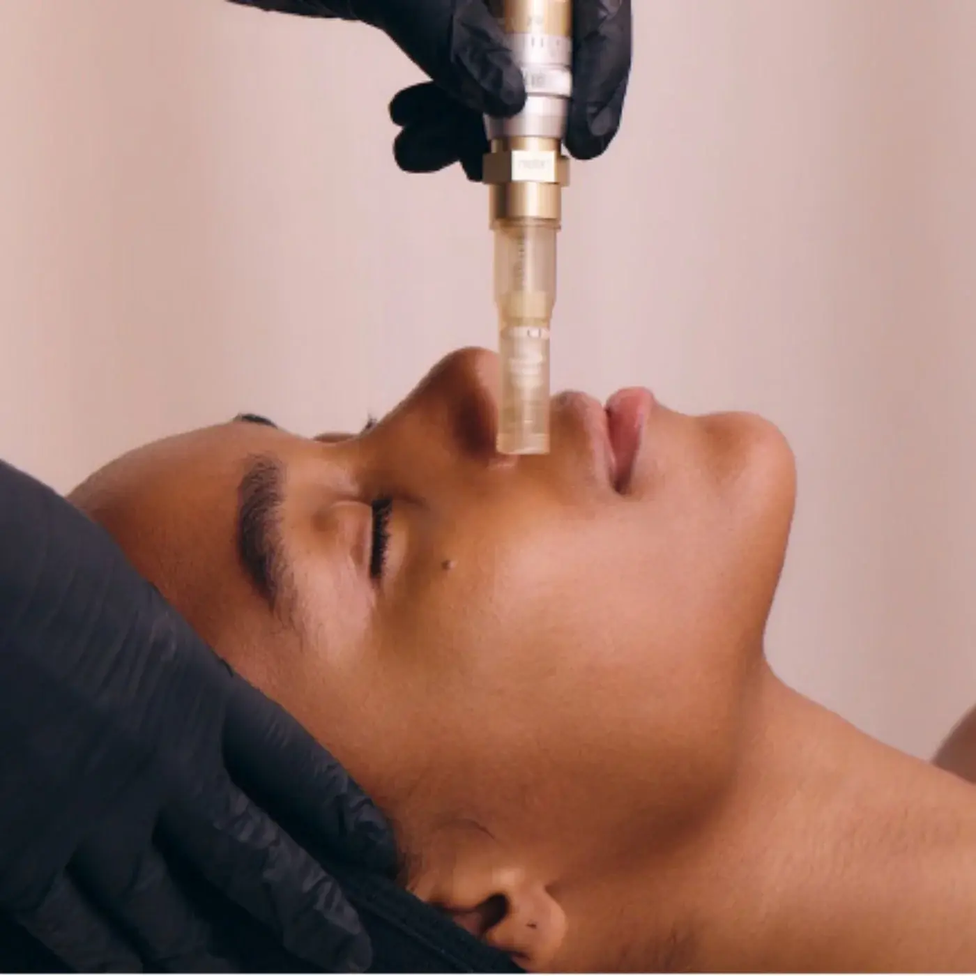 SkinStylus microneedling